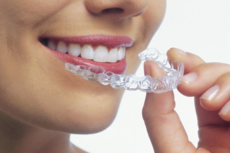 Embracing Your Smile with Clear Aligners: A Comprehensive Guide to Modern Orthodontics at Soleil Dental Studio